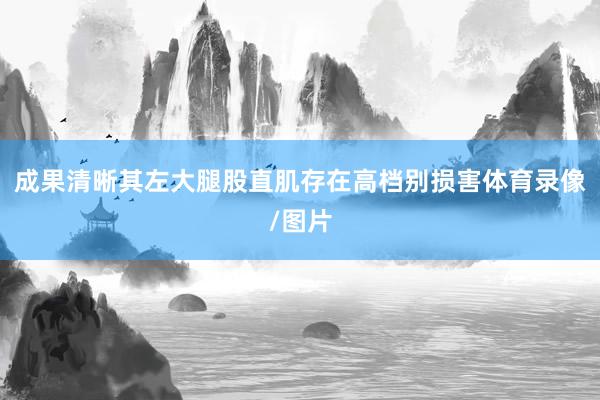 成果清晰其左大腿股直肌存在高档别损害体育录像/图片